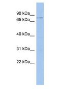 MEIOC Antibody - C17orf104 antibody Western Blot of HT1080 cell lysate.  This image was taken for the unconjugated form of this product. Other forms have not been tested.
