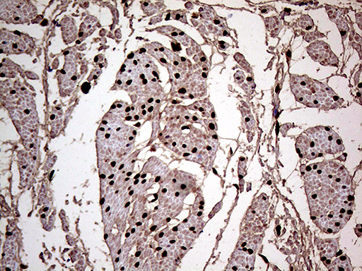 MEIS1 Antibody - Immunohistochemical staining of paraffin-embedded Human bladder tissue within the normal limits using anti-MEIS1 mouse monoclonal antibody. (Heat-induced epitope retrieval by 1mM EDTA in 10mM Tris buffer. (pH8.5) at 120°C for 3 min. (1:2000)