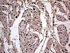 MEIS1 Antibody - Immunohistochemical staining of paraffin-embedded Human bladder tissue within the normal limits using anti-MEIS1 mouse monoclonal antibody. (Heat-induced epitope retrieval by 1mM EDTA in 10mM Tris buffer. (pH8.5) at 120°C for 3 min. (1:2000)