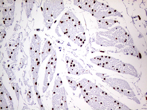 MEIS1 Antibody - Immunohistochemical staining of paraffin-embedded Human bladder tissue within the normal limits using anti-MEIS1 mouse monoclonal antibody. (Heat-induced epitope retrieval by 1mM EDTA in 10mM Tris buffer. (pH8.5) at 120°C for 3 min. (1:500)