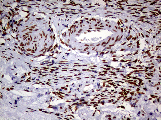 MEIS1 Antibody - Immunohistochemical staining of paraffin-embedded Human Ovary tissue within the normal limits using anti-MEIS1 mouse monoclonal antibody. (Heat-induced epitope retrieval by 1mM EDTA in 10mM Tris buffer. (pH8.5) at 120°C for 3 min. (1:500)