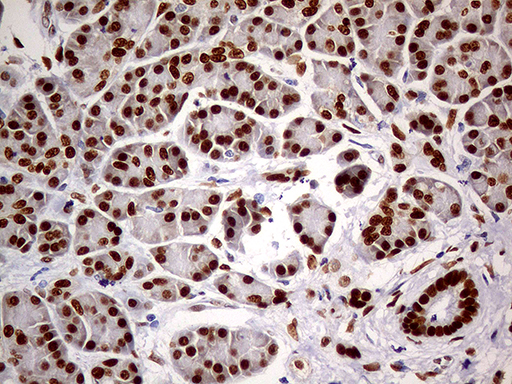 MEIS1 Antibody - Immunohistochemical staining of paraffin-embedded Human pancreas tissue within the normal limits using anti-MEIS1 mouse monoclonal antibody. (Heat-induced epitope retrieval by 1mM EDTA in 10mM Tris buffer. (pH8.5) at 120°C for 3 min. (1:500)