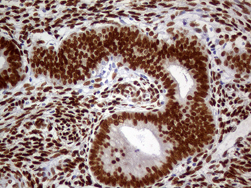 MEIS1 Antibody - Immunohistochemical staining of paraffin-embedded Human endometrium tissue within the normal limits using anti-MEIS1 mouse monoclonal antibody. (Heat-induced epitope retrieval by 1mM EDTA in 10mM Tris buffer. (pH8.5) at 120°C for 3 min. (1:500)
