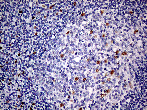 MEIS1 Antibody - Immunohistochemical staining of paraffin-embedded Human tonsil within the normal limits using anti-MEIS1 mouse monoclonal antibody. (Heat-induced epitope retrieval by 1mM EDTA in 10mM Tris buffer. (pH8.5) at 120°C for 3 min. (1:500)