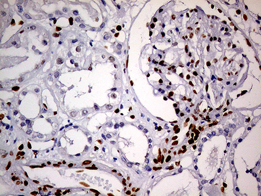 MEIS1 Antibody - Immunohistochemical staining of paraffin-embedded Human Kidney tissue within the normal limits using anti-MEIS1 mouse monoclonal antibody. (Heat-induced epitope retrieval by 1mM EDTA in 10mM Tris buffer. (pH8.5) at 120°C for 3 min. (1:500)