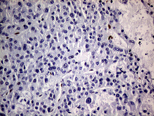 MEIS1 Antibody - Immunohistochemical staining of paraffin-embedded Human liver tissue within the normal limits using anti-MEIS1 mouse monoclonal antibody.This figure shows negative staining. (Heat-induced epitope retrieval by 1mM EDTA in 10mM Tris buffer. (pH8.5) at 120°C for 3 min. (1:500)