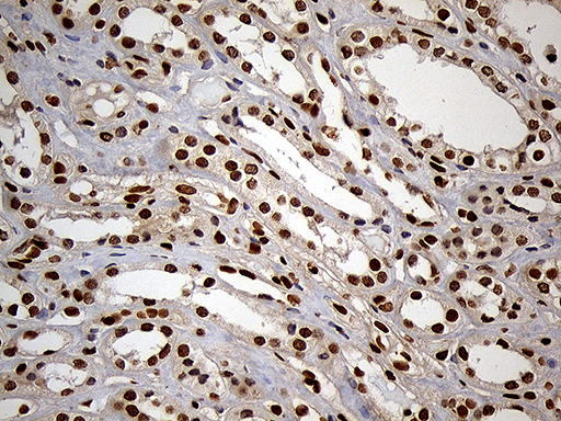 MEIS1 Antibody - Immunohistochemical staining of paraffin-embedded Human Kidney tissue within the normal limits using anti-MEIS1 mouse monoclonal antibody. (Heat-induced epitope retrieval by 1mM EDTA in 10mM Tris buffer. (pH8.5) at 120°C for 3 min. (1:500)