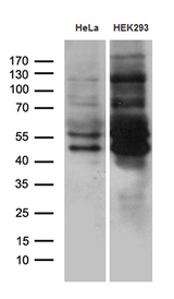 MEIS1 Antibody - Western blot analysis of extracts. (35ug) from 2 different cell lines by using anti-MEIS1 monoclonal antibody. (1:500)