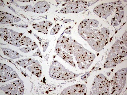 MEIS1 Antibody - Immunohistochemical staining of paraffin-embedded Human bladder tissue within the normal limits using anti-MEIS1 mouse monoclonal antibody. (Heat-induced epitope retrieval by 1mM EDTA in 10mM Tris buffer. (pH8.5) at 120°C for 3 min. (1:500)