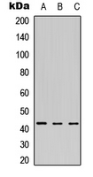 MEIS1 Antibody - Western blot analysis of MEIS1 expression in K562 (A); HeLa (B); mouse brain (C) whole cell lysates.