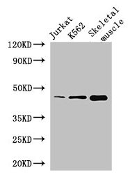 MEIS1 Antibody - Western Blot Positive WB detected in: Jurkat whole cell lysate, K562 whole cell lysate, Mouse skeletal muscle tissue All lanes: MEIS1 antibody at 2.8µg/ml Secondary Goat polyclonal to rabbit IgG at 1/50000 dilution Predicted band size: 44, 51 kDa Observed band size: 44 kDa