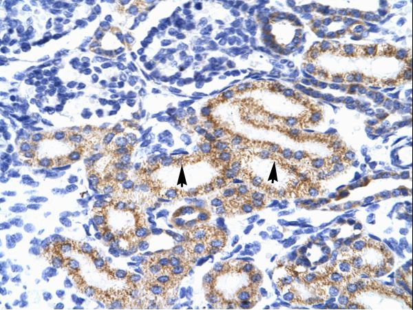 MEIS2 Antibody - MEIS2 antibody ARP34684_T100-NP_733775-MEIS2 (Meis homeobox 2) Antibody was used in IHC to stain formalin-fixed, paraffin-embedded human kidney.  This image was taken for the unconjugated form of this product. Other forms have not been tested.