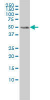 MEIS2 Antibody - MEIS2 monoclonal antibody (M01), clone 1H4 Western blot of MEIS2 expression in HeLa.