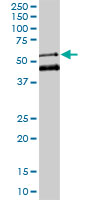 MEIS2 Antibody - MEIS2 monoclonal antibody (M01), clone 1H4. Western blot of MEIS2 expression in K-562.