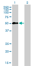 MEIS2 Antibody - Western blot of MEIS2 expression in transfected 293T cell line by MEIS2 monoclonal antibody (M01), clone 1H4.