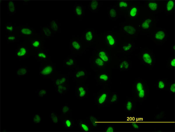 MEIS2 Antibody - Immunofluorescence of monoclonal antibody to MEIS2 on HeLa cell. [antibody concentration 10 ug/ml]