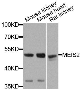 MEIS2 Antibody - Western blot analysis of extracts of various cells.