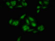 MEIS2 Antibody - Immunofluorescent analysis of Hela cells at a dilution of 1:100 and Alexa Fluor 488-congugated AffiniPure Goat Anti-Rabbit IgG(H+L)