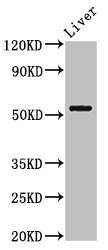MEIS2 Antibody - Positive Western Blot detected in Mouse liver tissue. All lanes: MEIS2 antibody at 3 µg/ml Secondary Goat polyclonal to rabbit IgG at 1/50000 dilution. Predicted band size: 52, 44, 33, 34, 42, 43 KDa. Observed band size: 52 KDa
