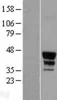 MEIS2 Protein - Western validation with an anti-DDK antibody * L: Control HEK293 lysate R: Over-expression lysate
