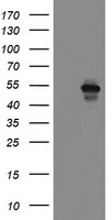 MEIS3 Antibody - HEK293T cells were transfected with the pCMV6-ENTRY control (Left lane) or pCMV6-ENTRY MEIS3 (Right lane) cDNA for 48 hrs and lysed. Equivalent amounts of cell lysates (5 ug per lane) were separated by SDS-PAGE and immunoblotted with anti-MEIS3.