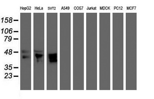 MEIS3 Antibody - Western blot of extracts (35ug) from 9 different cell lines by using anti-MEIS3 monoclonal antibody (HepG2: human; HeLa: human; SVT2: mouse; A549: human; COS7: monkey; Jurkat: human; MDCK: canine; PC12: rat; MCF7: human).