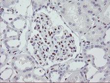 MEIS3 Antibody - IHC of paraffin-embedded Human Kidney tissue using anti-MEIS3 mouse monoclonal antibody.