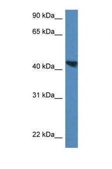 MEIS3 Antibody - MEIS3 antibody Western blot of Rat Lung lysate. Antibody concentration 1 ug/ml.  This image was taken for the unconjugated form of this product. Other forms have not been tested.