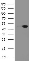 MEIS3 Antibody - HEK293T cells were transfected with the pCMV6-ENTRY control (Left lane) or pCMV6-ENTRY MEIS3 (Right lane) cDNA for 48 hrs and lysed. Equivalent amounts of cell lysates (5 ug per lane) were separated by SDS-PAGE and immunoblotted with anti-MEIS3.