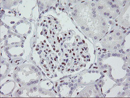 MEIS3 Antibody - IHC of paraffin-embedded Human Kidney tissue using anti-MEIS3 mouse monoclonal antibody.