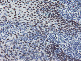 MEIS3 Antibody - IHC of paraffin-embedded Human tonsil using anti-MEIS3 mouse monoclonal antibody.