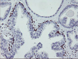 MEIS3 Antibody - IHC of paraffin-embedded Human prostate tissue using anti-MEIS3 mouse monoclonal antibody.