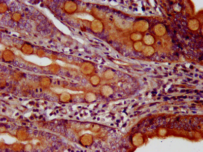 MEIS3 Antibody - Immunohistochemistry image at a dilution of 1:200 and staining in paraffin-embedded human small intestine tissue performed on a Leica BondTM system. After dewaxing and hydration, antigen retrieval was mediated by high pressure in a citrate buffer (pH 6.0) . Section was blocked with 10% normal goat serum 30min at RT. Then primary antibody (1% BSA) was incubated at 4 °C overnight. The primary is detected by a biotinylated secondary antibody and visualized using an HRP conjugated SP system.