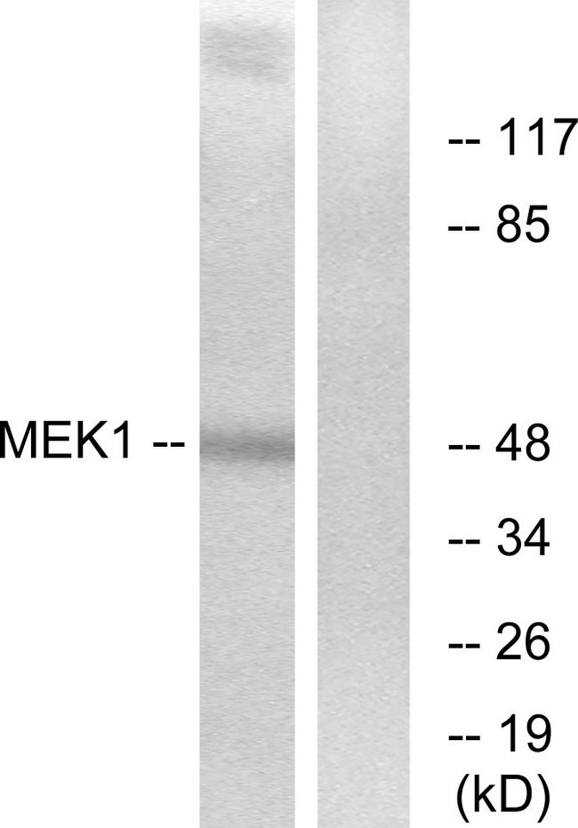 MEK1 + MEK2 Antibody - Western blot analysis of lysates from Jurkat cells, treated with UV, using MEK1/2 Antibody. The lane on the right is blocked with the synthesized peptide.