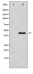 MEK1 + MEK2 Antibody - Western blot of MEK1/2 expression in UV treated Jurkat whole cell lysates,The lane on the left is treated with the antigen-specific peptide.