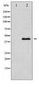 MEK1 + MEK2 Antibody - Western blot of MEK1/2 expression in UV treated Jurkat whole cell lysates,The lane on the left is treated with the antigen-specific peptide.