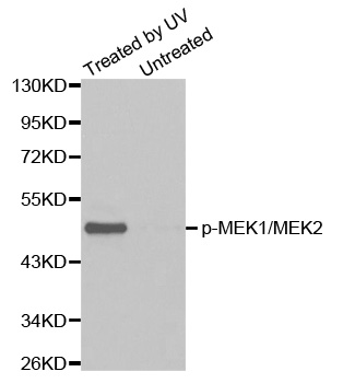 MEK1 + MEK2 Antibody - Western blot analysis of extracts from Hela cell untreated or treated with UV.