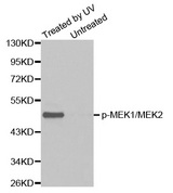 MEK1 + MEK2 Antibody - Western blot analysis of extracts from Hela cell untreated or treated with UV.