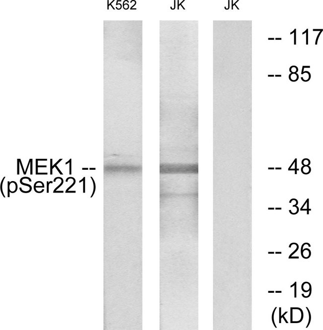 MEK1 + MEK2 Antibody - Western blot analysis of lysates from K562 cells treated with serum 20% 15' and Jurkat cells treated with EGF, using MEK1/2 (Phospho-Ser221) Antibody. The lane on the right is blocked with the phospho peptide.