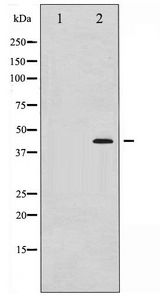 MEK1 + MEK2 Antibody - Western blot of MEK1/2 phosphorylation expression in UV treated Jurkat whole cell lysates,The lane on the left is treated with the antigen-specific peptide.