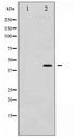 MEK1 + MEK2 Antibody - Western blot of MEK1/2 phosphorylation expression in UV treated Jurkat whole cell lysates,The lane on the left is treated with the antigen-specific peptide.