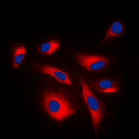 MEK1 + MEK2 Antibody - Immunofluorescent analysis of MKK1/2 (pS222/226) staining in K562 cells. Formalin-fixed cells were permeabilized with 0.1% Triton X-100 in TBS for 5-10 minutes and blocked with 3% BSA-PBS for 30 minutes at room temperature. Cells were probed with the primary antibody in 3% BSA-PBS and incubated overnight at 4 C in a humidified chamber. Cells were washed with PBST and incubated with a DyLight 594-conjugated secondary antibody (red) in PBS at room temperature in the dark. DAPI was used to stain the cell nuclei (blue).