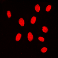 MEK3/6 Antibody - Immunofluorescent analysis of MKK3/6 staining in Jurkat cells. Formalin-fixed cells were permeabilized with 0.1% Triton X-100 in TBS for 5-10 minutes and blocked with 3% BSA-PBS for 30 minutes at room temperature. Cells were probed with the primary antibody in 3% BSA-PBS and incubated overnight at 4 C in a humidified chamber. Cells were washed with PBST and incubated with a DyLight 594-conjugated secondary antibody (red) in PBS at room temperature in the dark. DAPI was used to stain the cell nuclei (blue).