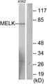 MELK Antibody - Western blot analysis of lysates from K562 cells, using MELK Antibody. The lane on the right is blocked with the synthesized peptide.