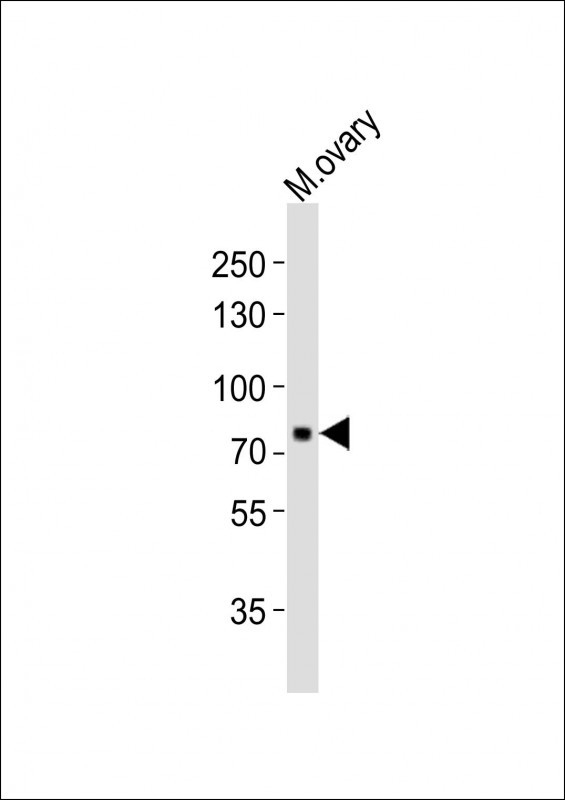 MELK Antibody - Anti-Melk Antibody at 1:1000 dilution + mouse ovary lysates Lysates/proteins at 20 ug per lane. Secondary Goat Anti-Rabbit IgG, (H+L), Peroxidase conjugated at 1/10000 dilution Predicted band size : 73 kDa Blocking/Dilution buffer: 5% NFDM/TBST.