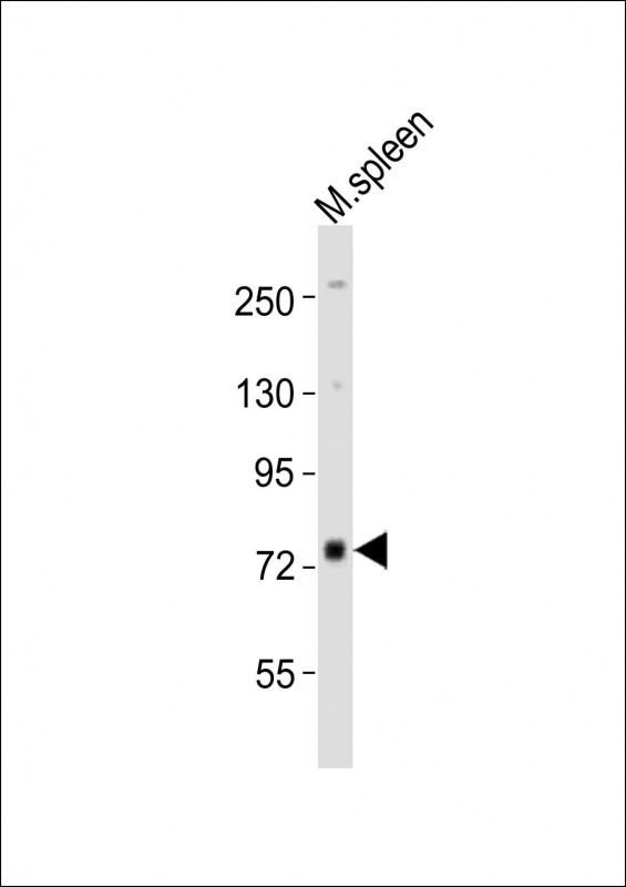 MELK Antibody - Anti-Melk Antibody at 1:2000 dilution + mouse spleen lysates Lysates/proteins at 20 ug per lane. Secondary Goat Anti-Rabbit IgG, (H+L), Peroxidase conjugated at 1/10000 dilution Predicted band size : 73 kDa Blocking/Dilution buffer: 5% NFDM/TBST.