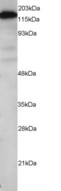 MELK Antibody - (0.1 ug/ml) Staining of Human Testis lysate (RIPA buffer, 1.4E5 cells per lane). Detected by chemiluminescence.