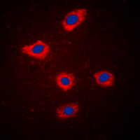 MELK Antibody - Immunofluorescent analysis of MELK staining in MCF7 cells. Formalin-fixed cells were permeabilized with 0.1% Triton X-100 in TBS for 5-10 minutes and blocked with 3% BSA-PBS for 30 minutes at room temperature. Cells were probed with the primary antibody in 3% BSA-PBS and incubated overnight at 4 C in a humidified chamber. Cells were washed with PBST and incubated with a DyLight 594-conjugated secondary antibody (red) in PBS at room temperature in the dark. DAPI was used to stain the cell nuclei (blue).