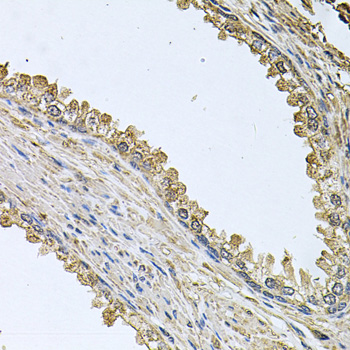 MEMO1 Antibody - Immunohistochemistry of paraffin-embedded human prostate.