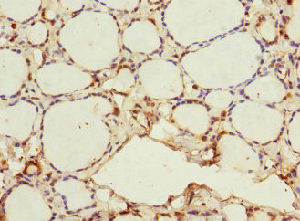 MEMO1 Antibody - Immunohistochemistry of paraffin-embedded human thyroid tissue at dilution 1:100